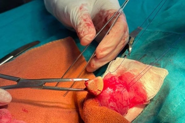 Surgically Removing Bladder Stones From A Dog